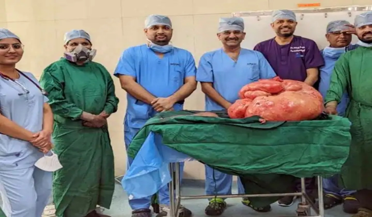 Doctors Remove 47-Kg Tumour From Woman's Abdomen, Biggest Non-Ovarian Tumour In Indian Records
